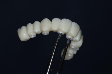 Advanced Concepts in Full-Arch Implant Restoration: FP1 Workflows
