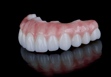 All-on-X FP3 Fundamentals: Modern Full-Arch Workflow