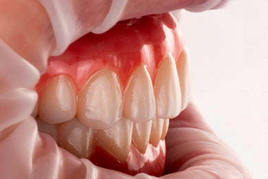 Fixed Full-Arch Implant Solutions: From Surgery to Final Prosthesis